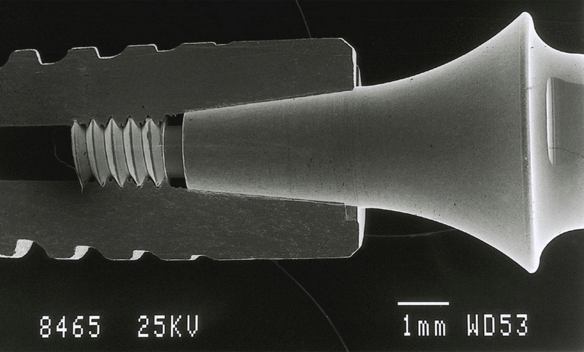 Coupe transversale MEB de l'interface implant-os Ankylos®
