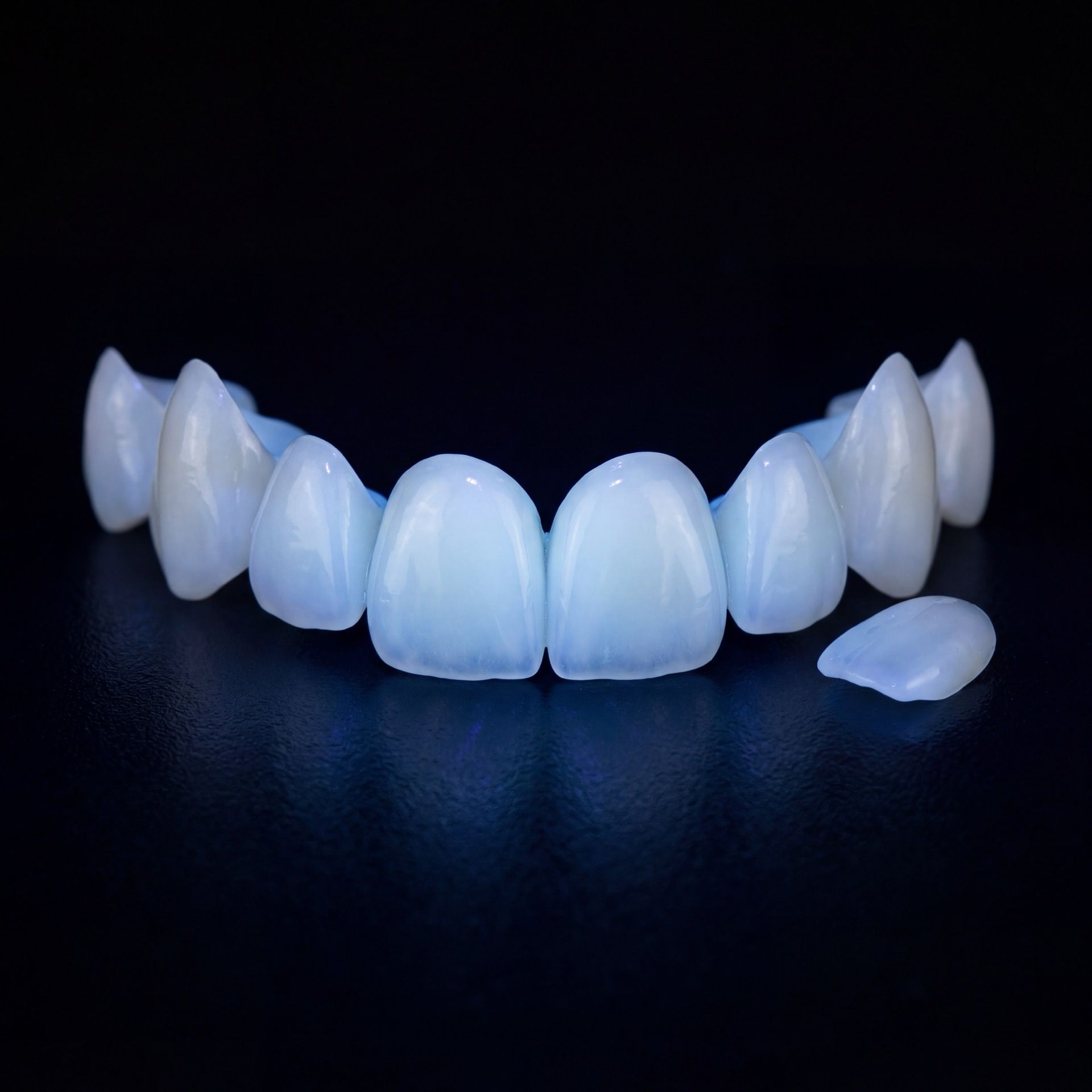 Nahaufnahme hauchdünner Zirkon-Veneers mit natürlicher Transluzenz und Zahnfarbe